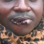 Drama in Kitui Woman Bites Husband