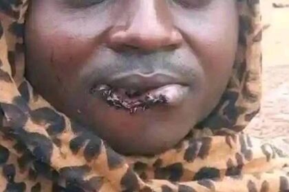 Drama in Kitui Woman Bites Husband