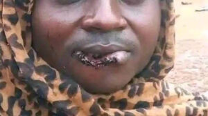 Drama in Kitui Woman Bites Husband